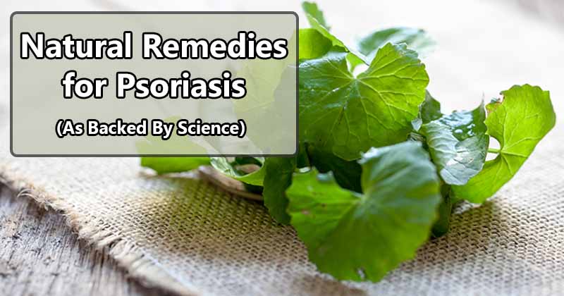 natural remedies for psoriasis
